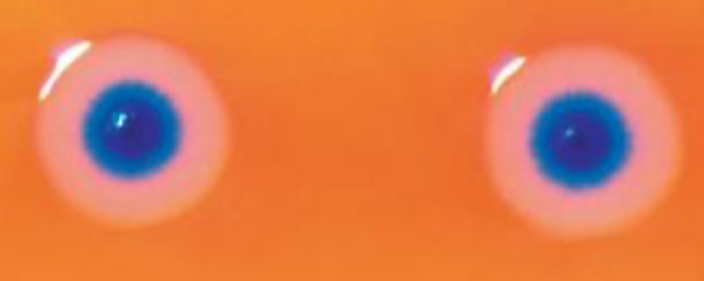 Primer transplante de genoma