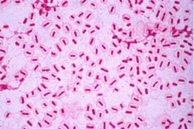 Haemophilus Influenzae