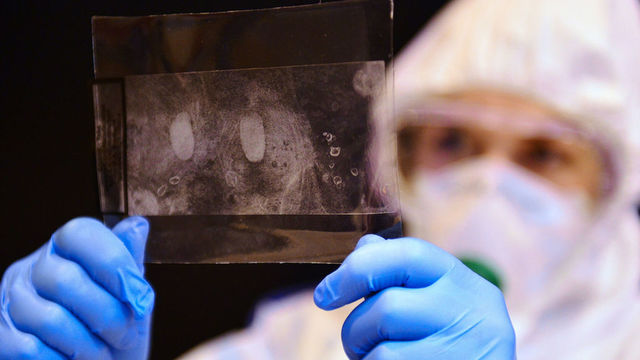 Huellas genéticas en investigación.