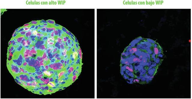 Identificada una proteína clave en la progresión de los tumores