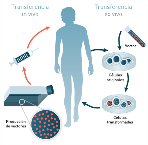 Primer tratamiento de terapia génica con éxito en niños