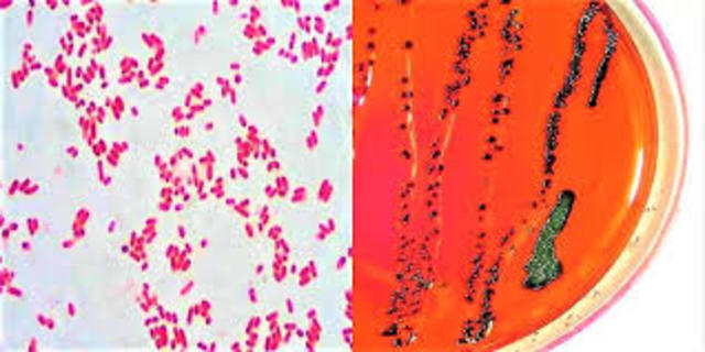 Se completan las secuencias genómicas del E. Coli y la levadura.