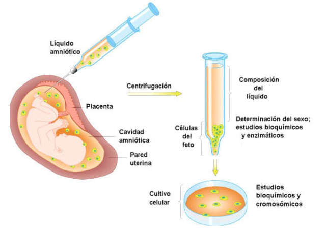 Primer diagnóstico prenatal de una enfermedad por ADN.