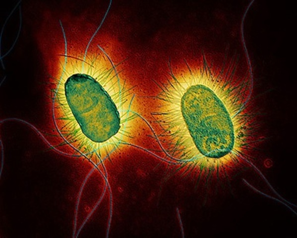 Mutaciones en E. coli