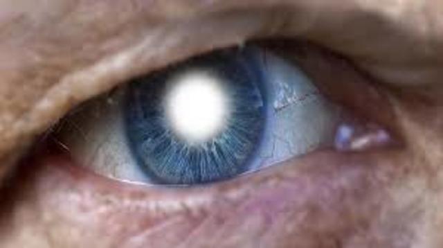 Genes encargados de la degeneracion macular