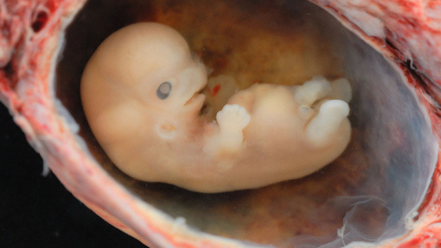 Primer Embrión Artificial