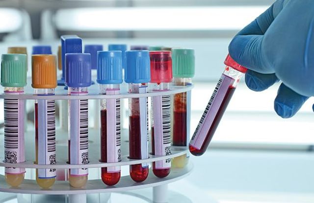 Recomendaciones para establecer normas