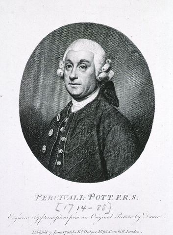 Percival Pott