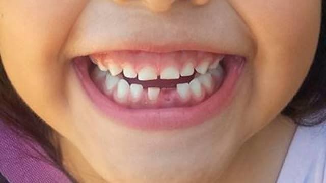 I pulled my first tooth at 5 years.