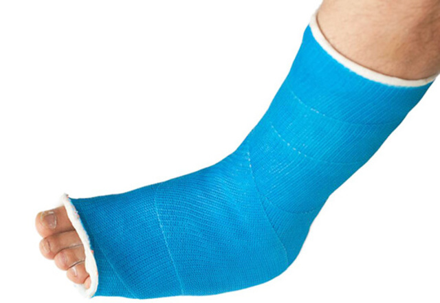Broken Ankle