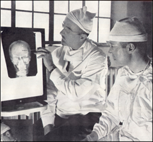 Popularidad de Lobotomías