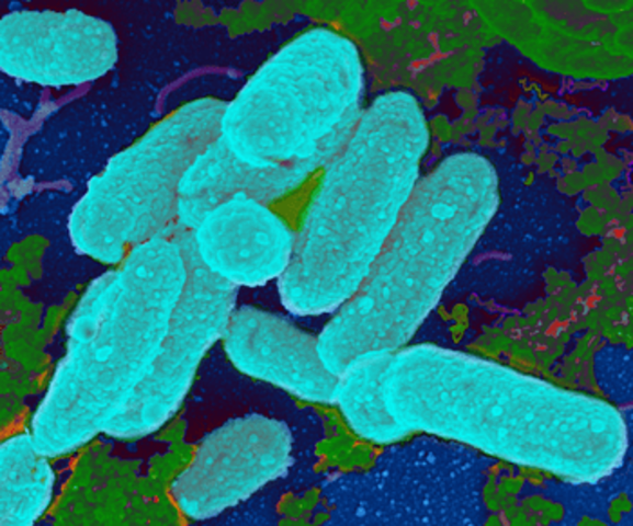 Haemophilus influenzae