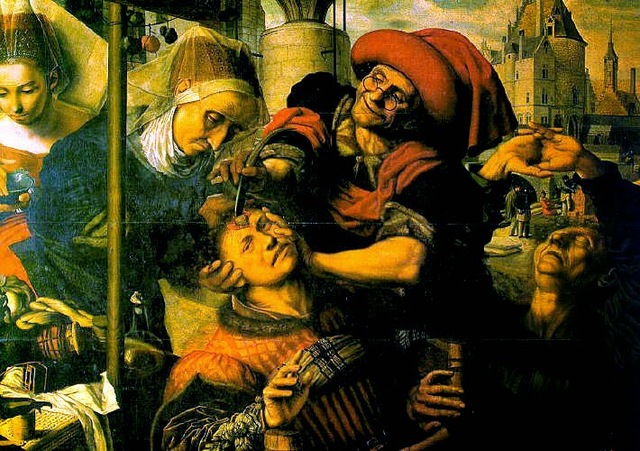 CIRUGÍA EN LA EDAD MEDIA