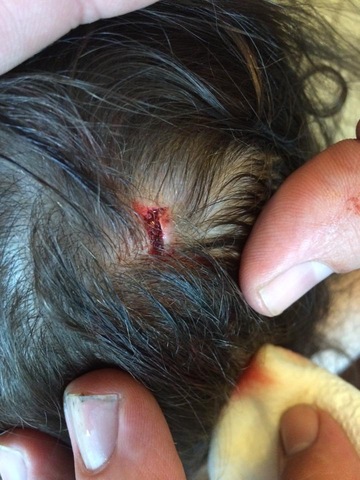 I get glue in my head