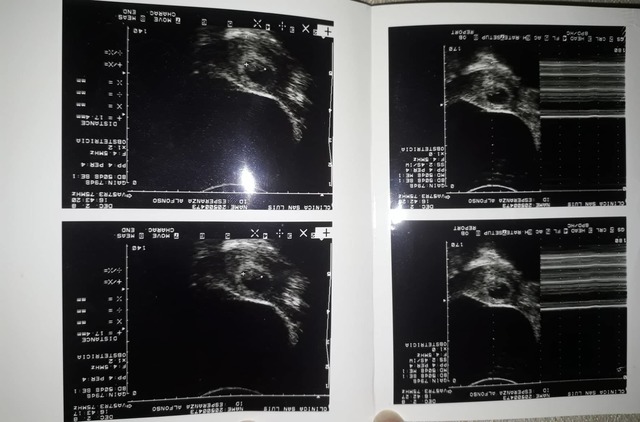 Arrival of my sister