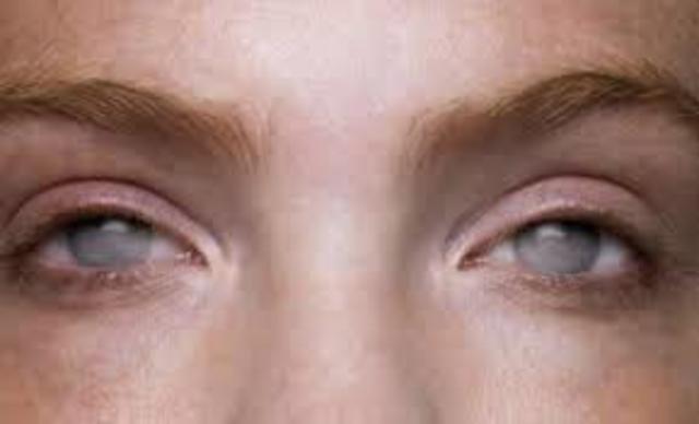 She lost his vision and died