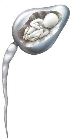 Teoría de la preformación