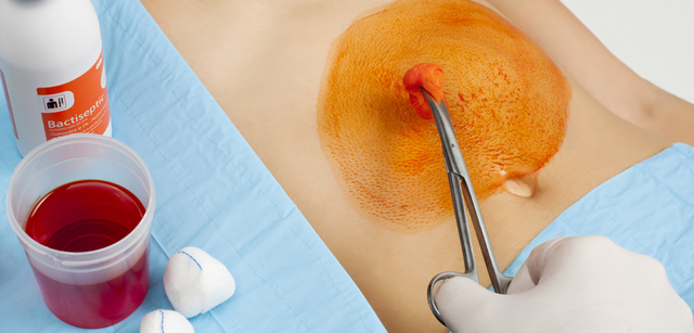 cirugía y antisepsia