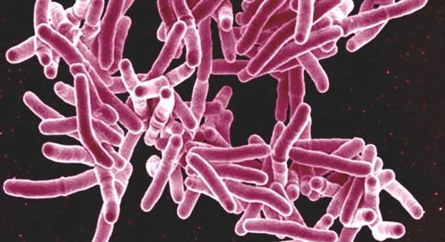 Descubrimiento de la bacteria causante de la tuberculosis