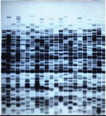 Se crean los marcadores de secuencia expresada (EST)