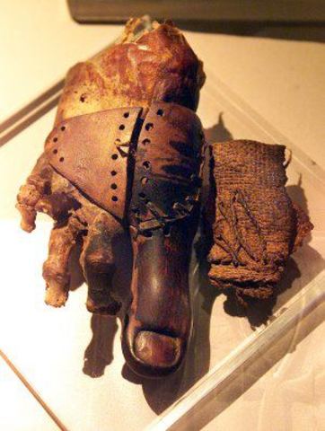 Prótesis del dedo gordo del pie