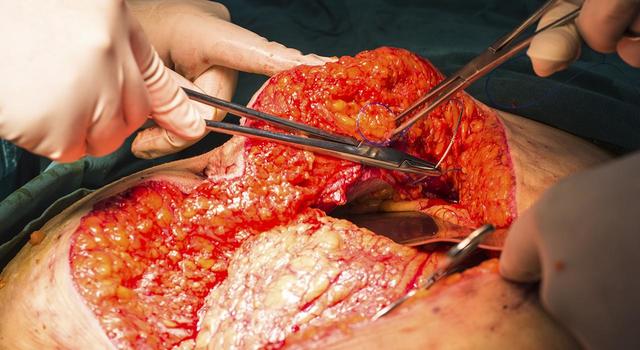 primer programa de instrumentación  quirurgica