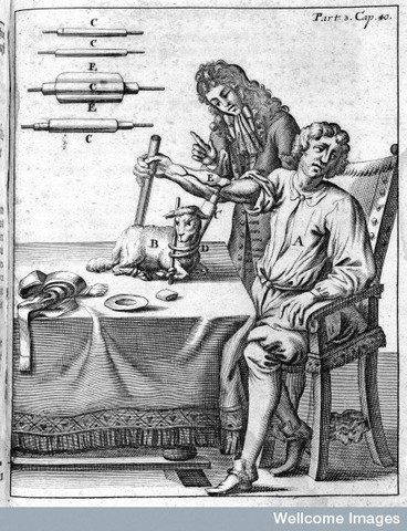 Invention: Blood Transfusion