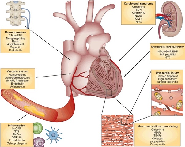 Cirugía Cardiovascular