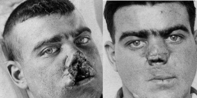 Cirugía Reconstructiva