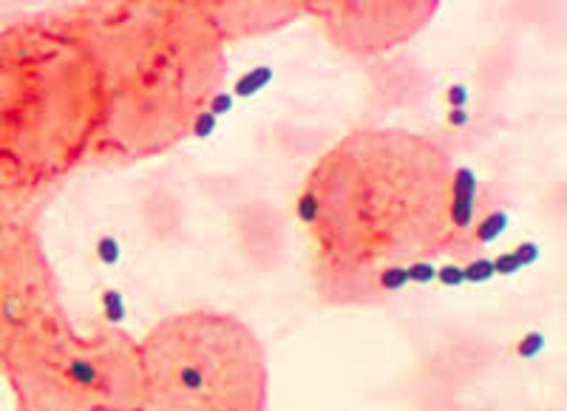 Diferencias entre bacterias