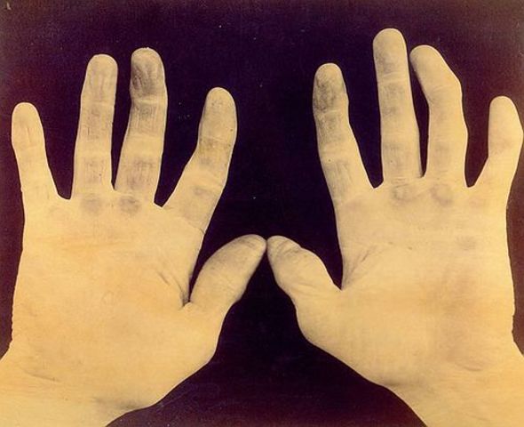 Doug Allison, Early MLB gloves