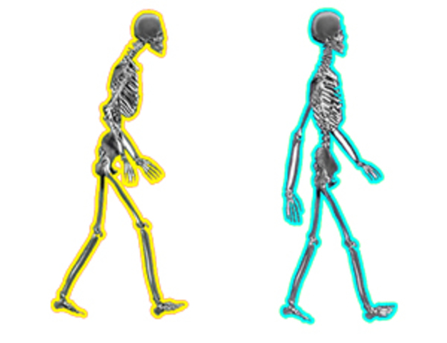 Metheny; Rask y Burke