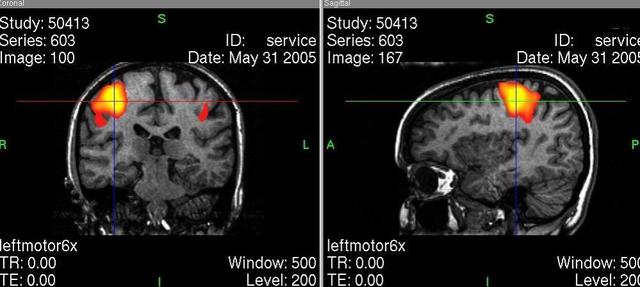 Resonancia Magnetica