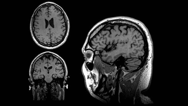 Resonancia Magnetica