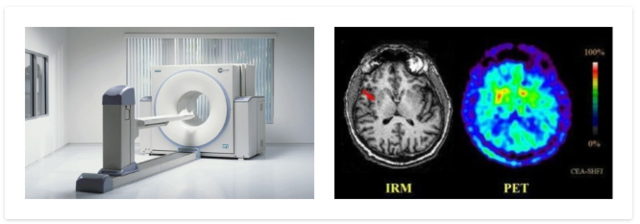 Tomografia por Emision de Positrones (PET)