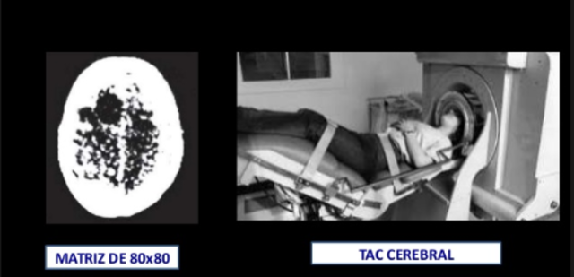 Tomografia axial Computarizada (TAC)