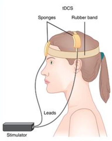 Estimulacion Transcraneal con corriente directa