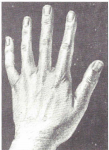 curación por el tacto