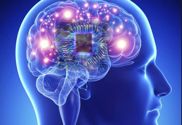 Implantes Neuronales