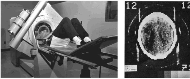 Primeras Tomografías Computarizadas.