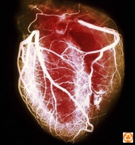 DERIVACIÓN ARTERIAL