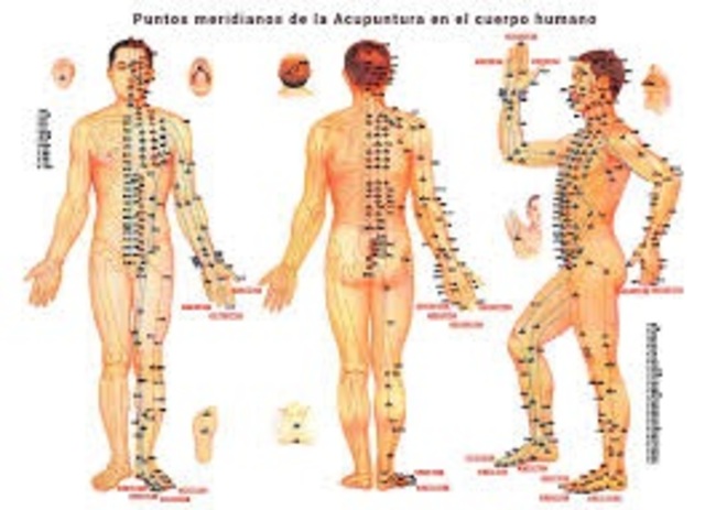 acupuntura