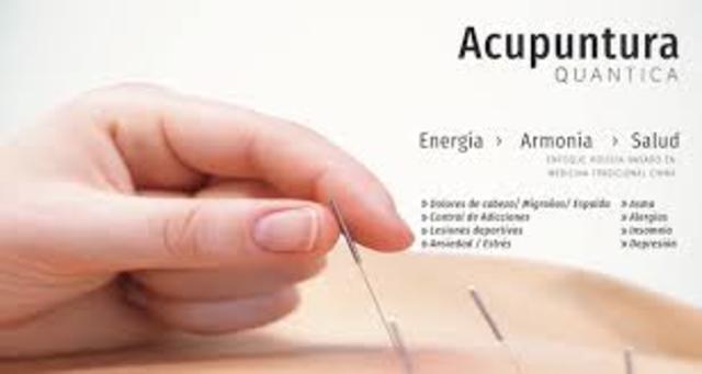 Acupuntura
