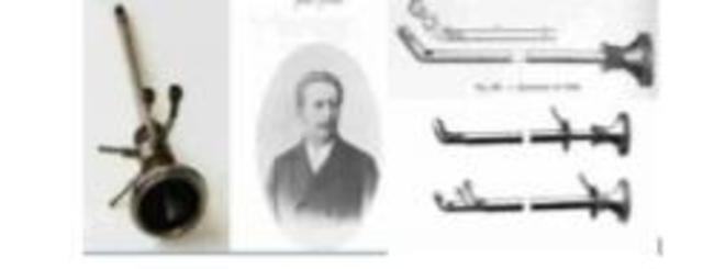 CISTOSCOPIO DE MAXIMILIAN NITZE