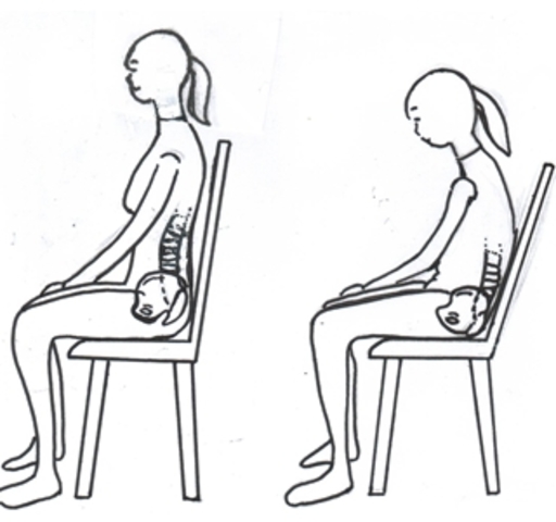 LA TÉCNICA DE ALEXANDER