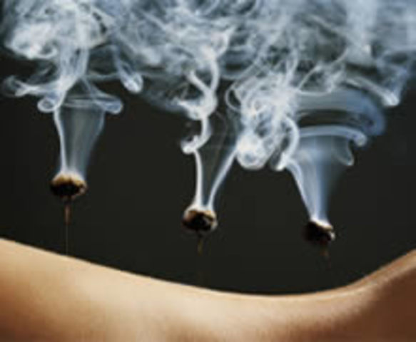 Acupuntura y moxibustion.