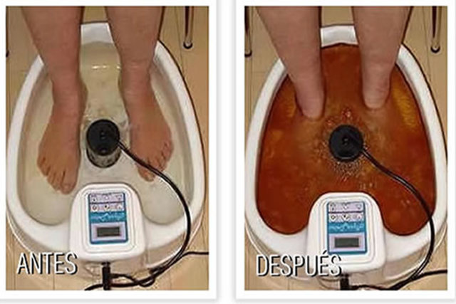 Desintoxicacion ionica