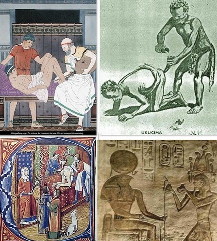 Hidroterapia de Colon