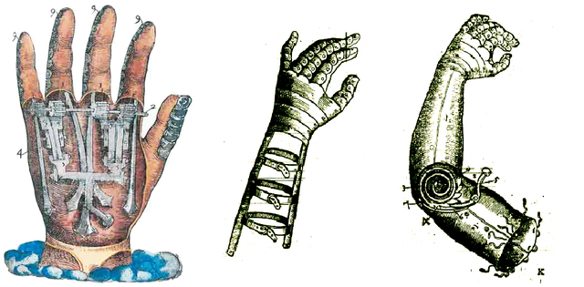 Primeras prótesis de Paré