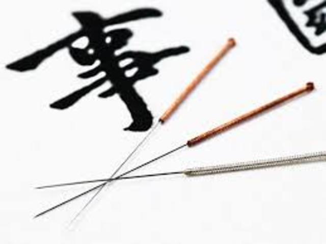 Acupuntura